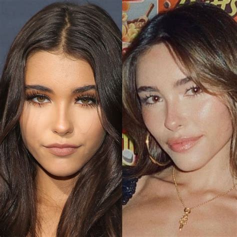 madison beer plastic surgery|Madison Beer Responds To Cosmetic Surgery Allegations